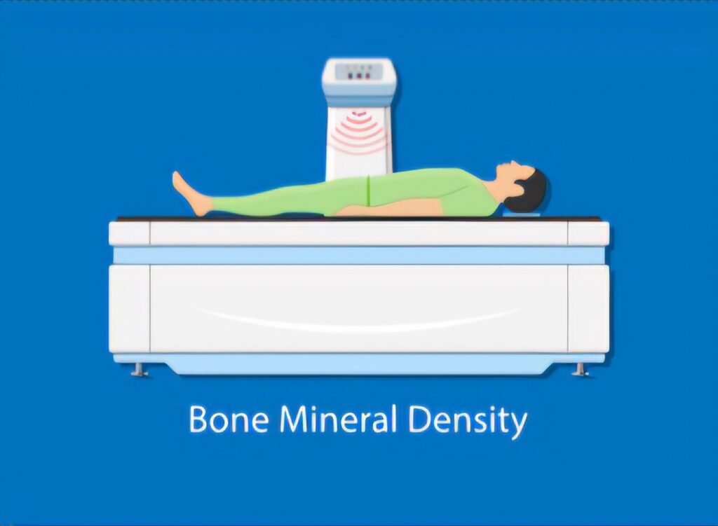 Bone Density Test (BMD)