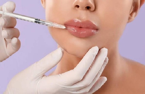 Lip fillers cost